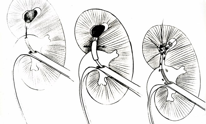 RezoSanté: « L’urologie à l’heure des nouvelles technologies » post thumbnail image